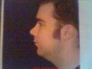 chin-before