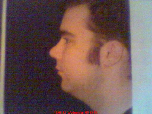 chin-before
